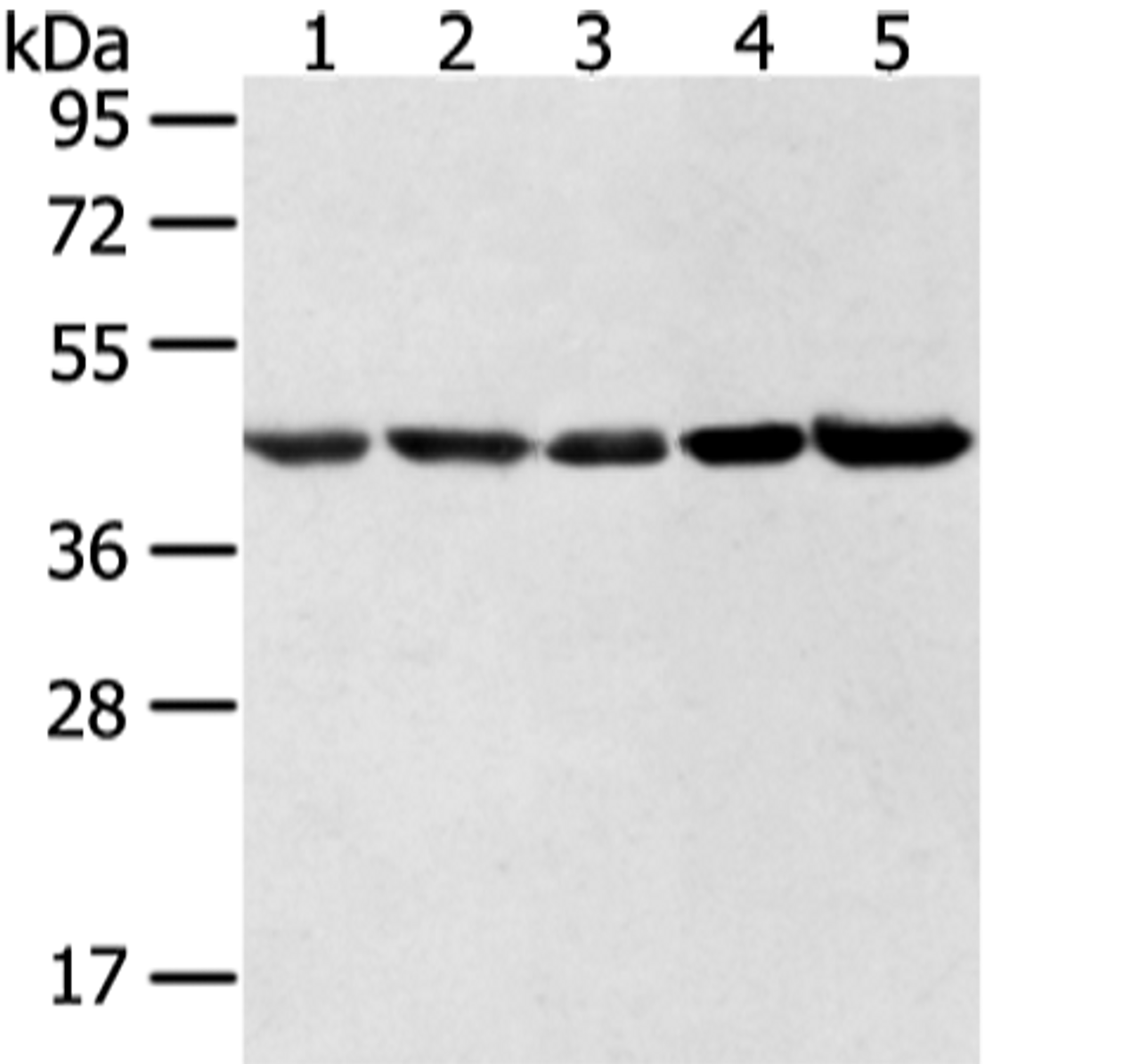 Western blot analysis of Hela lncap NIH/3T3 K562 and 231 cell  using WDR77 Polyclonal Antibody at dilution of 1:500