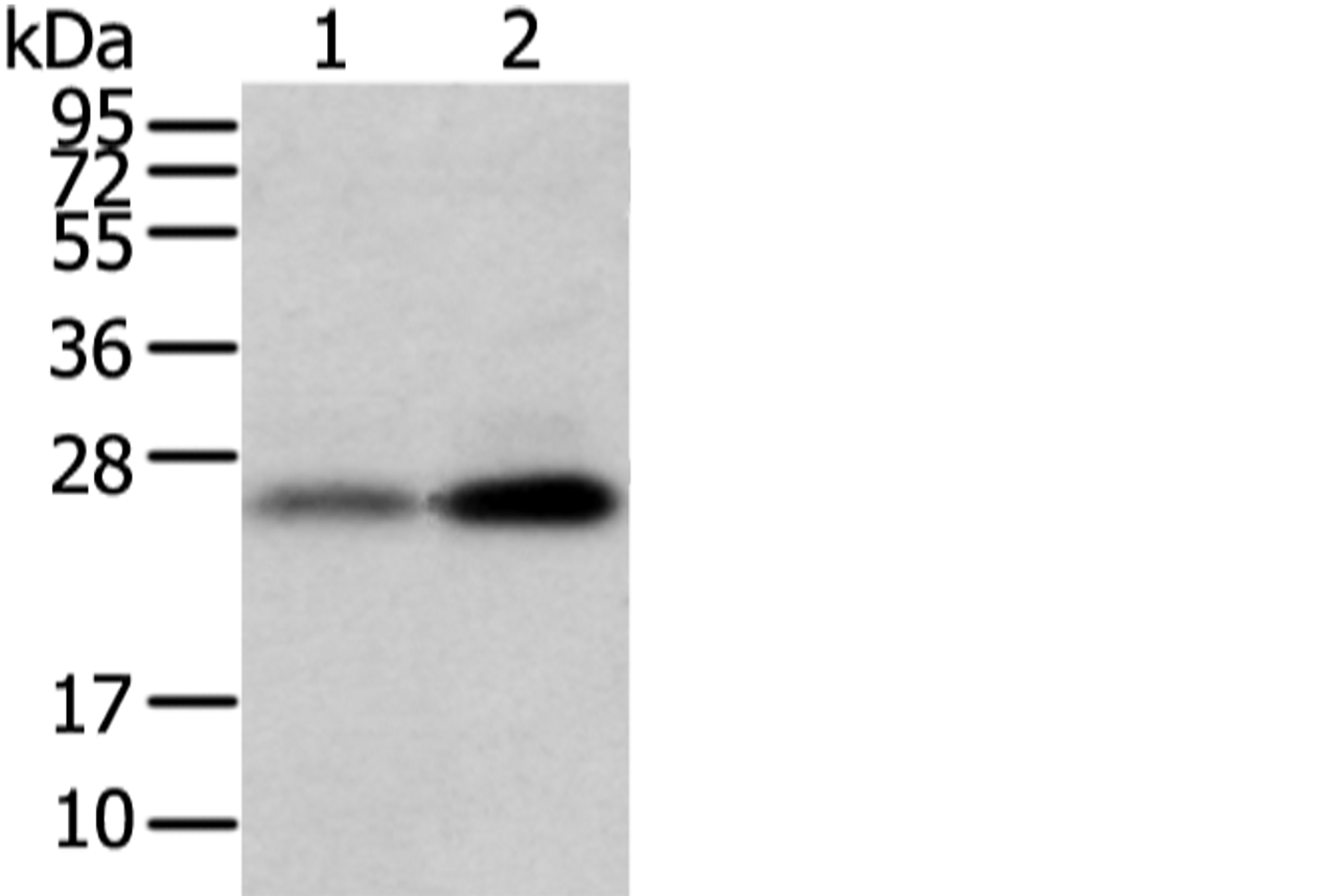 Western blot analysis of Mouse trachea and brain tissue  using WFDC5 Polyclonal Antibody at dilution of 1:1100