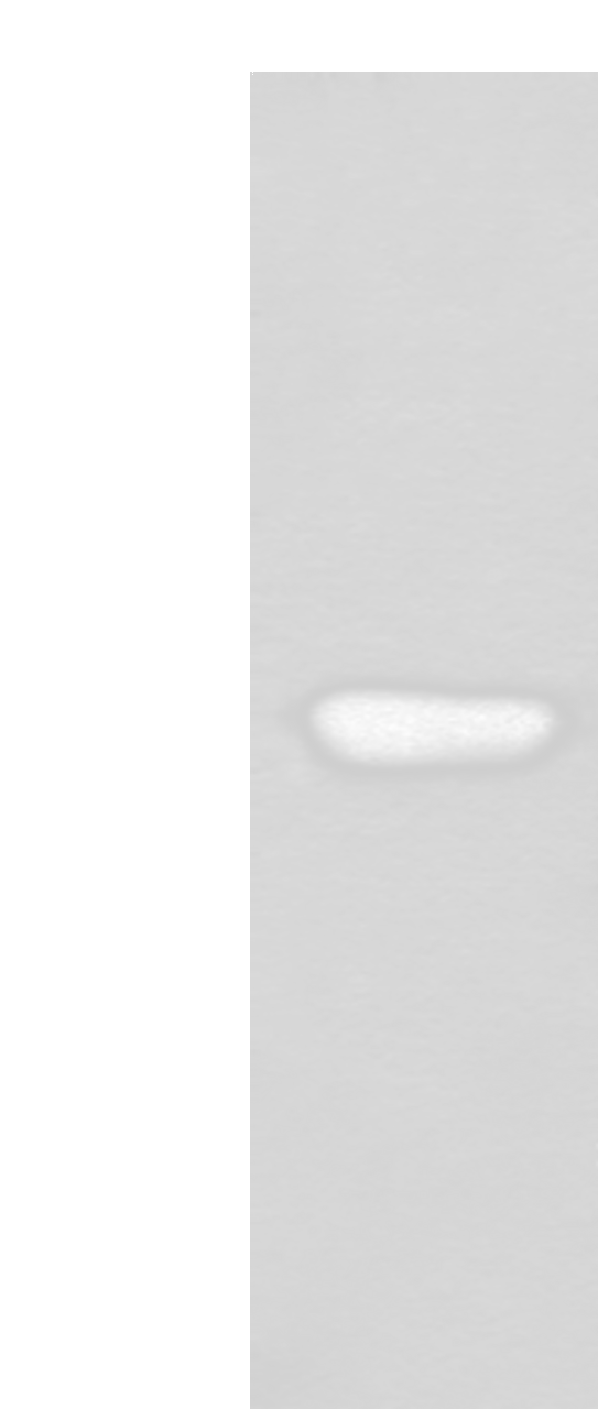 Western blot analysis of Human fetal liver tissue lysate  using HNRNPH2 Polyclonal Antibody at dilution of 1:400