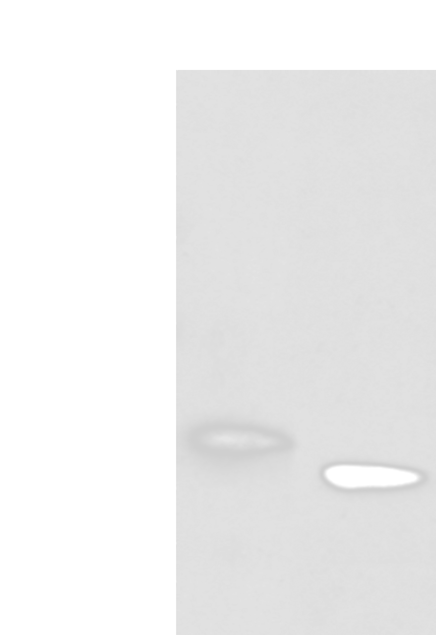 Western blot analysis of A172 cell and mouse kidney tissue  using LRRC19 Polyclonal Antibody at dilution of 1:450