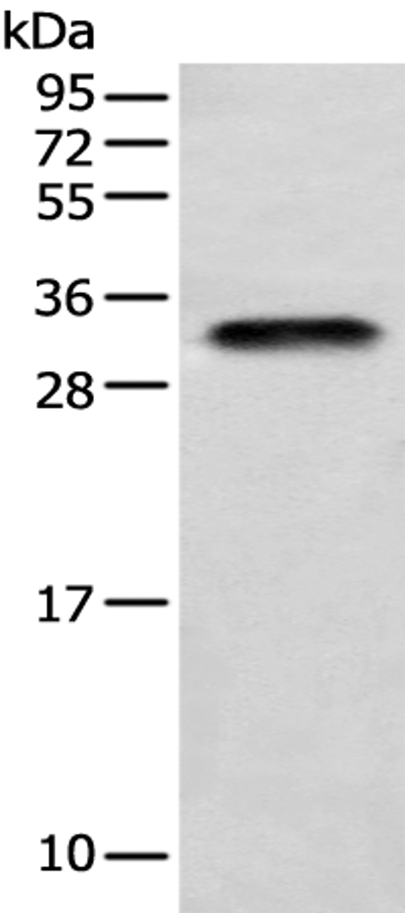 Western blot analysis of Human testis tissue  using LYPD4 Polyclonal Antibody at dilution of 1:400
