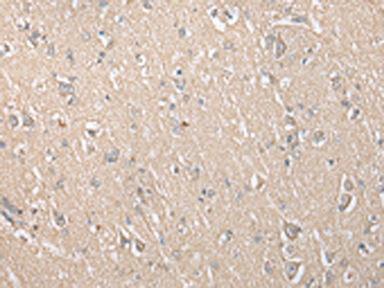 Immunohistochemistry of paraffin-embedded Human brain tissue  using ECI1 Polyclonal Antibody at dilution of 1:30(×200)