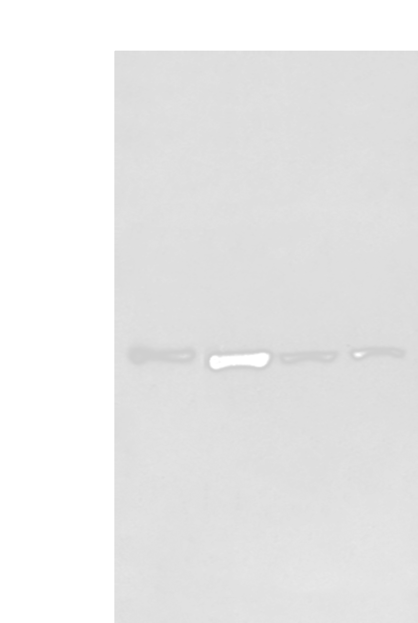 Western blot analysis of Raw264.7 A549 Hepg2 and Jurkat cell  using GCLC Polyclonal Antibody at dilution of 1:800