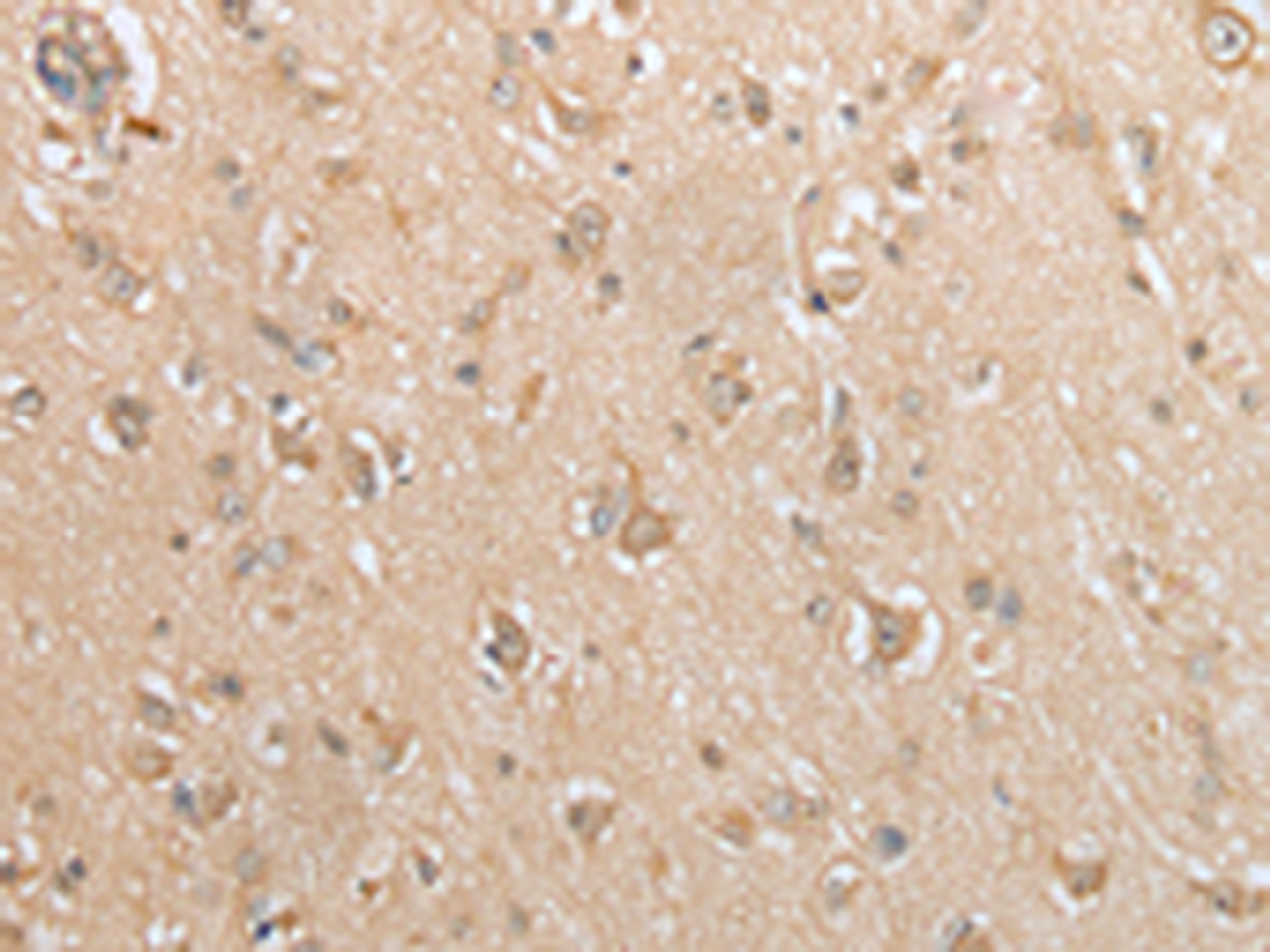 Immunohistochemistry of paraffin-embedded Human brain tissue  using GCLC Polyclonal Antibody at dilution of 1:35(×200)