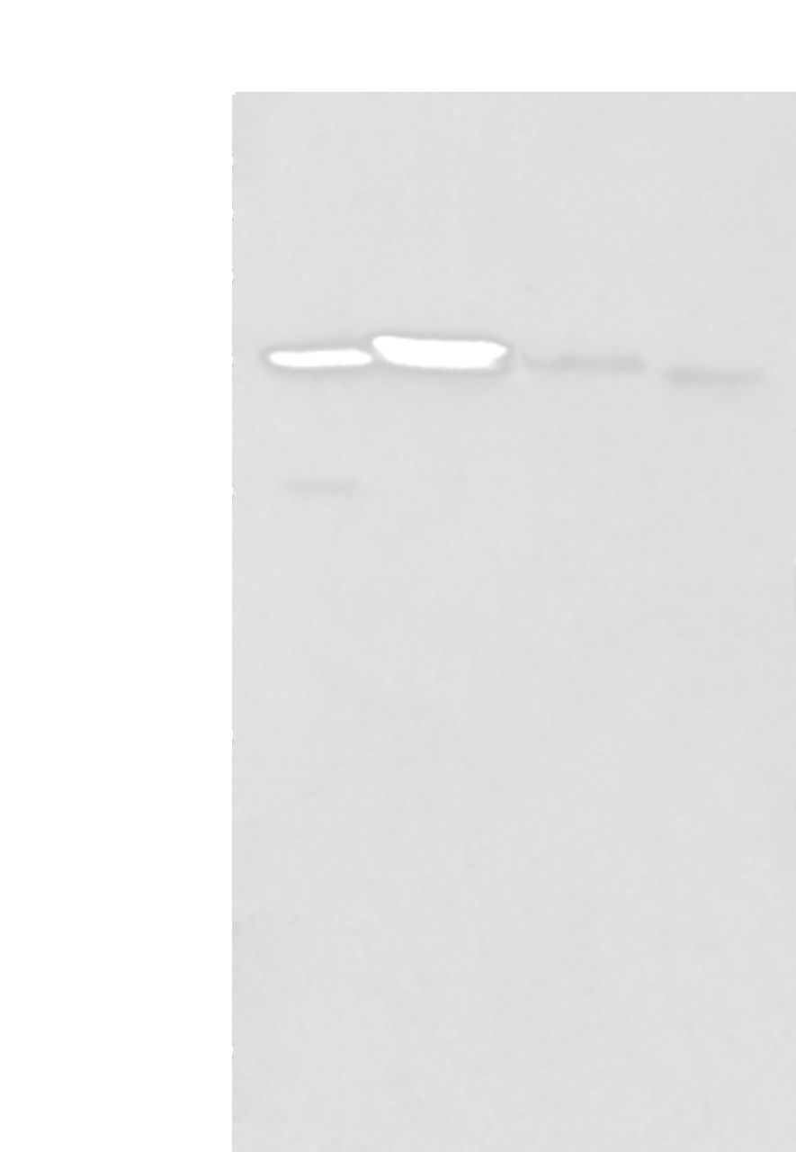 Western blot analysis of 293T cell Mouse brain tissue and Human kidney tissue lysates  using LASP1 Polyclonal Antibody at dilution of 1:350