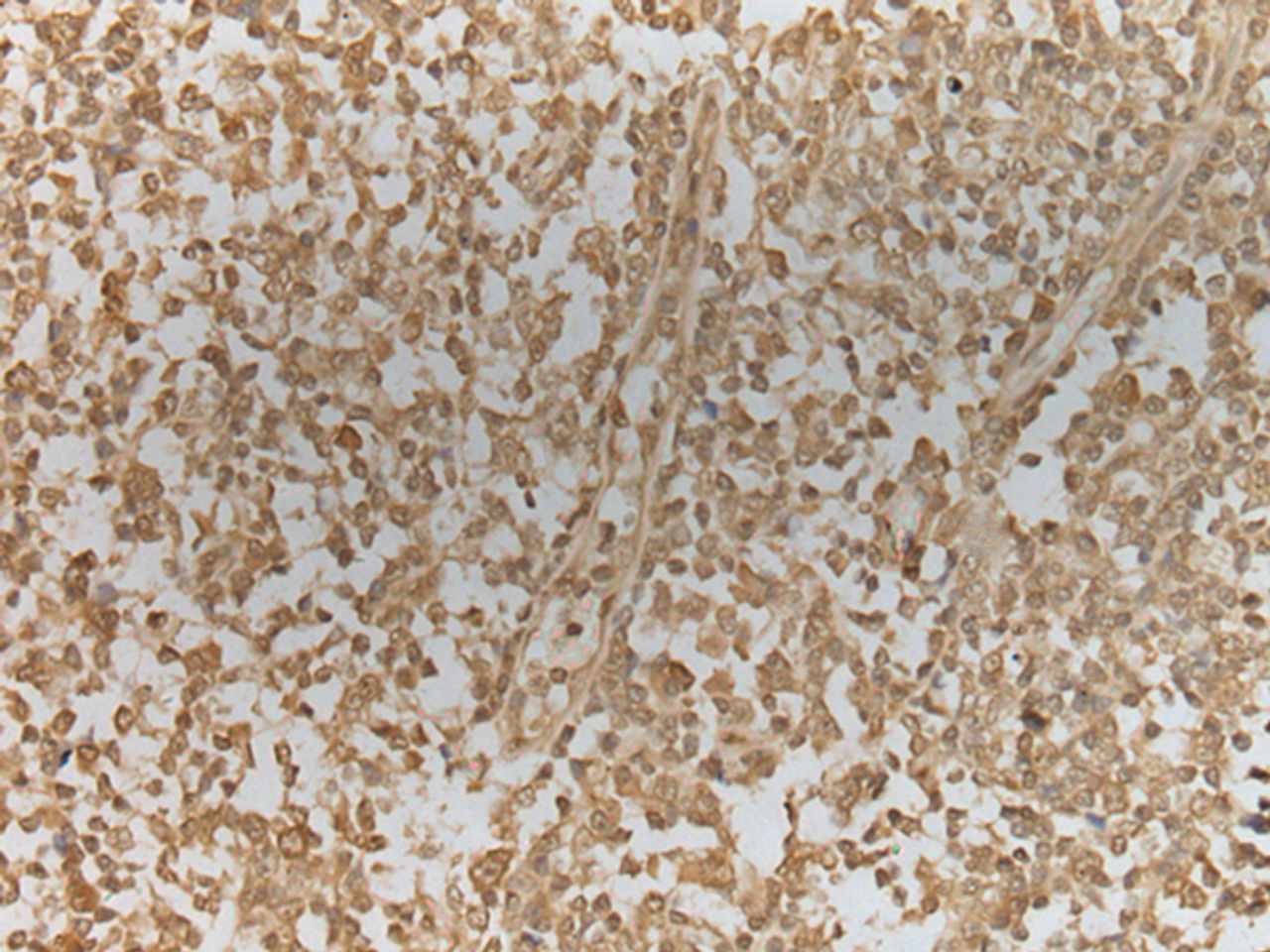Immunohistochemistry of paraffin-embedded Human tonsil tissue  using ZNF8 Polyclonal Antibody at dilution of 1:40(×200)