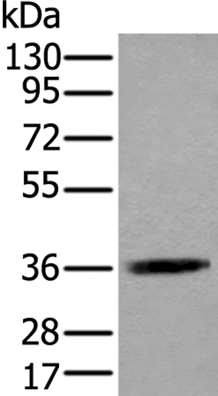 Western blot analysis of Jurkat cell lysate  using ACAT2 Polyclonal Antibody at dilution of 1:550