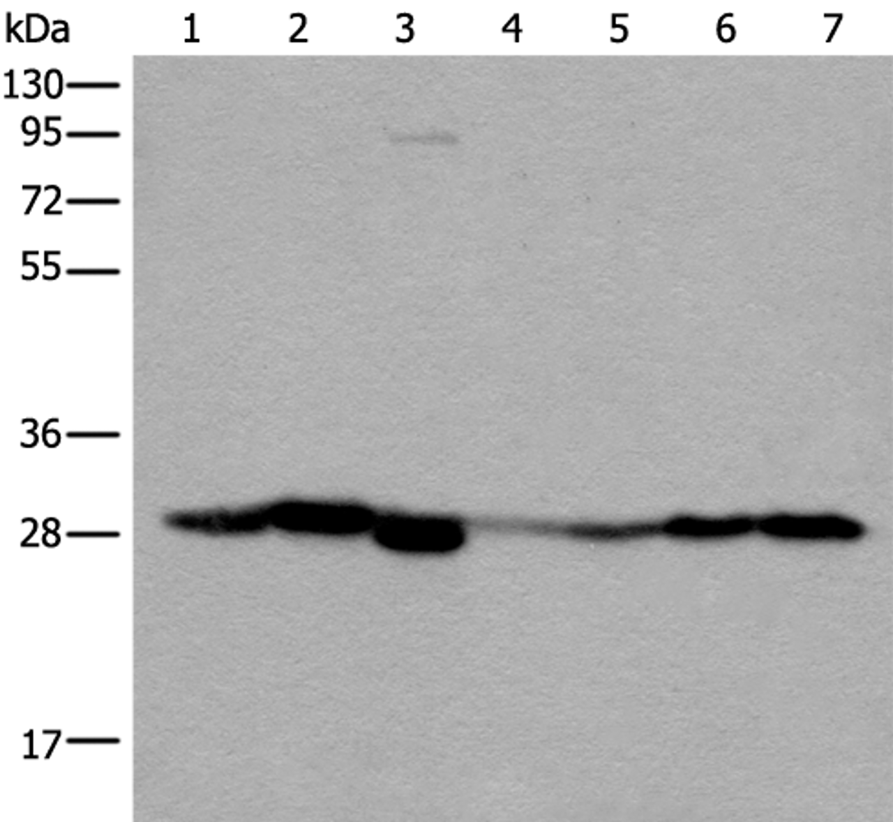 Western blot analysis of Human kidney tissue RAW264.7 cell Mouse kidney tissue Human lung tissue Human fetal liver tissue Hela and 231 cell lysates  using VTI1B Polyclonal Antibody at dilution of 1:300