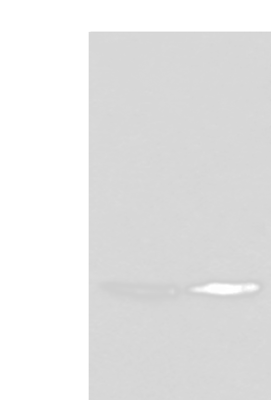 Western blot analysis of 231 cell and Human cerebrum tissue lysates  using UBE2W Polyclonal Antibody at dilution of 1:550