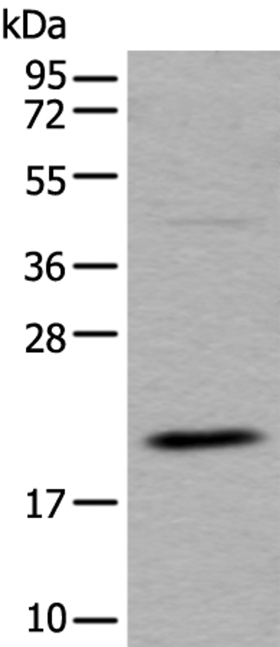 Western blot analysis of RAW264.7 cell lysate  using UFC1 Polyclonal Antibody at dilution of 1:500
