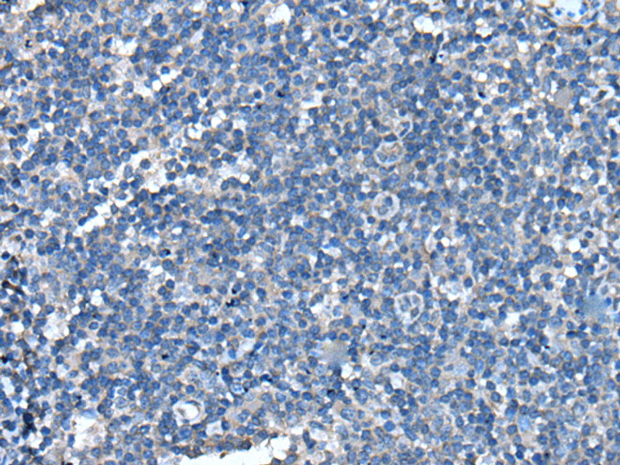 Immunohistochemistry of paraffin-embedded Human tonsil tissue  using UFC1 Polyclonal Antibody at dilution of 1:50(×200)