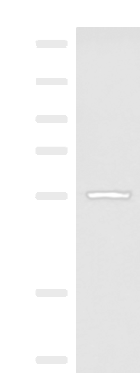 Western blot analysis of Human cerebella tissue lysate  using CAMKK1 Polyclonal Antibody at dilution of 1:700