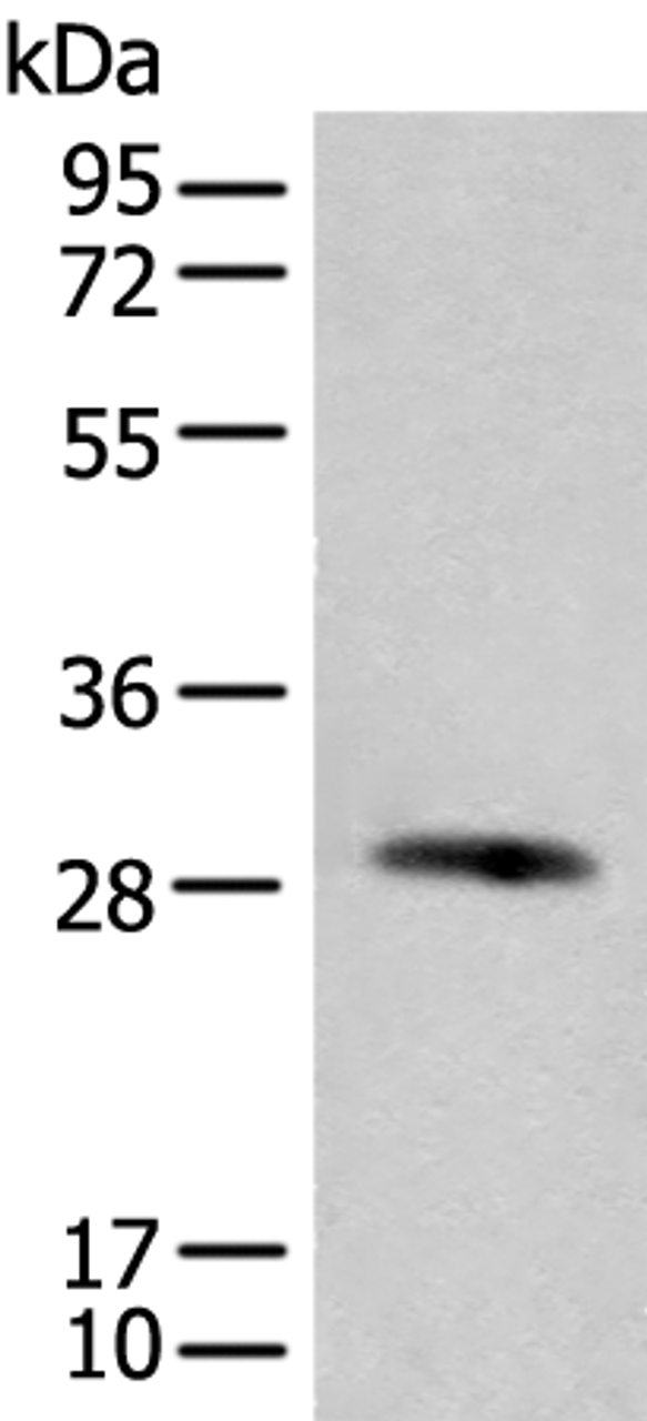 Western blot analysis of Human urinary bladder tissue lysate  using CFHR2 Polyclonal Antibody at dilution of 1:550