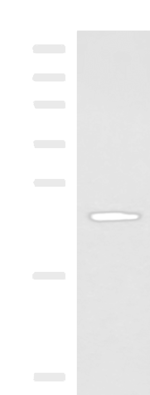 Western blot analysis of Human fetal liver tissue lysate  using CMPK1 Polyclonal Antibody at dilution of 1:700