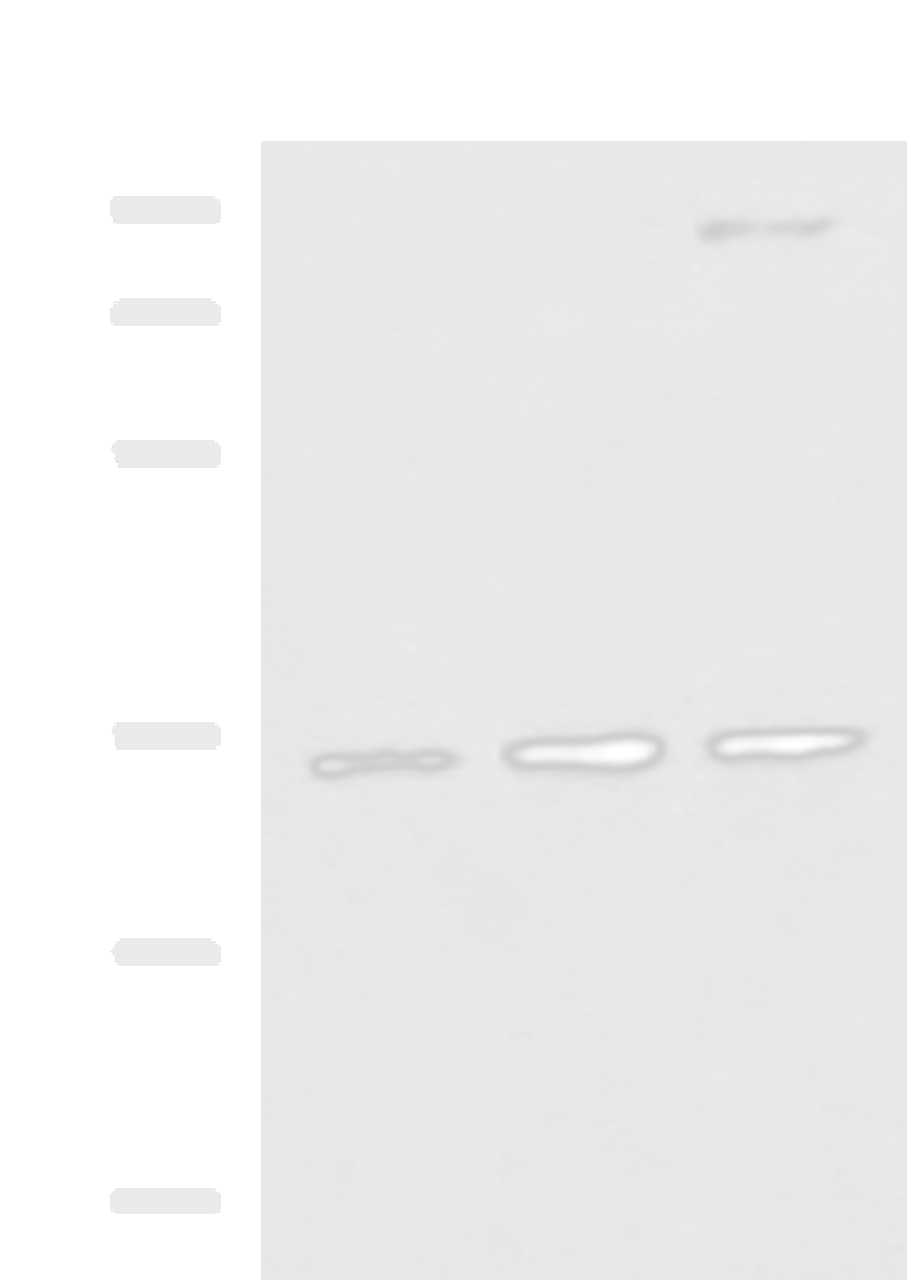 Western blot analysis of HepG2 A431 and Raji cell lysates  using STX5 Polyclonal Antibody at dilution of 1:1000