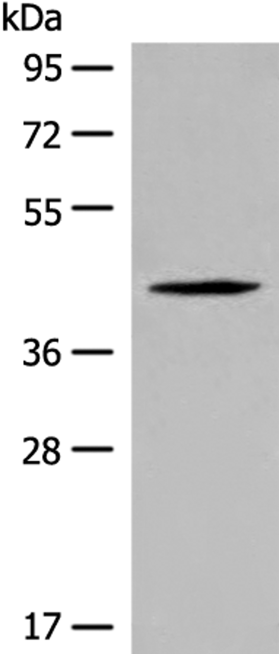 Western blot analysis of Jurkat cell lysate  using QTRT1 Polyclonal Antibody at dilution of 1:450