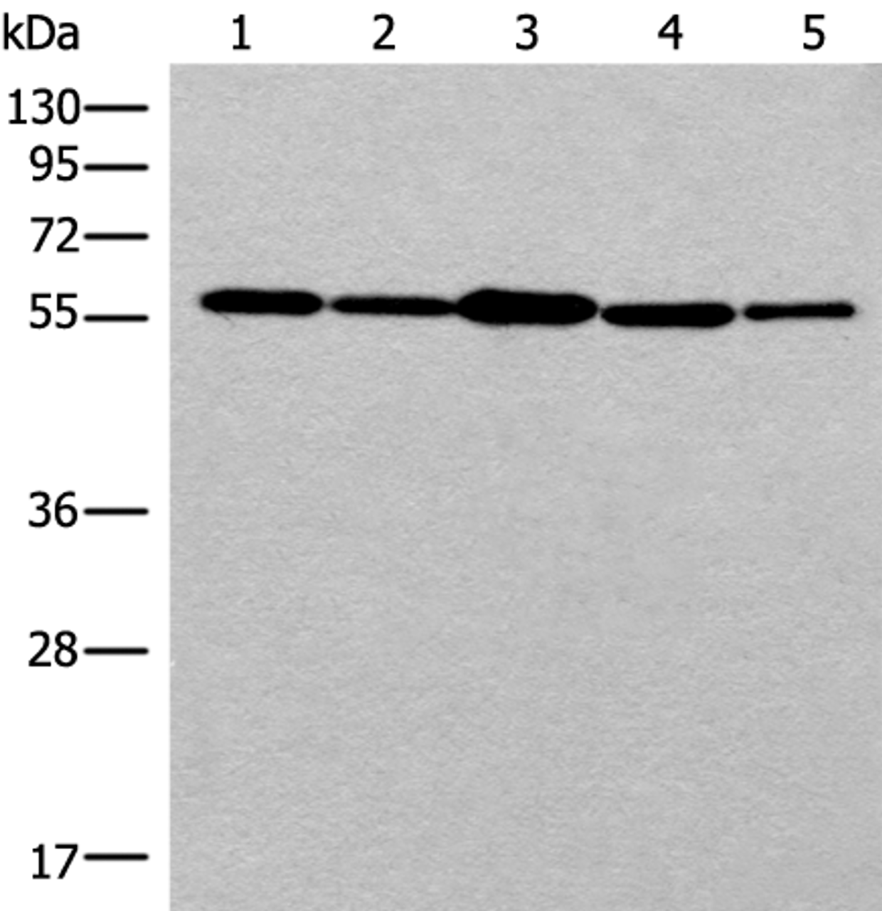 Western blot analysis of 293T cell HUVEC cell Hela cell lysates  using RAD23B Polyclonal Antibody at dilution of 1:350