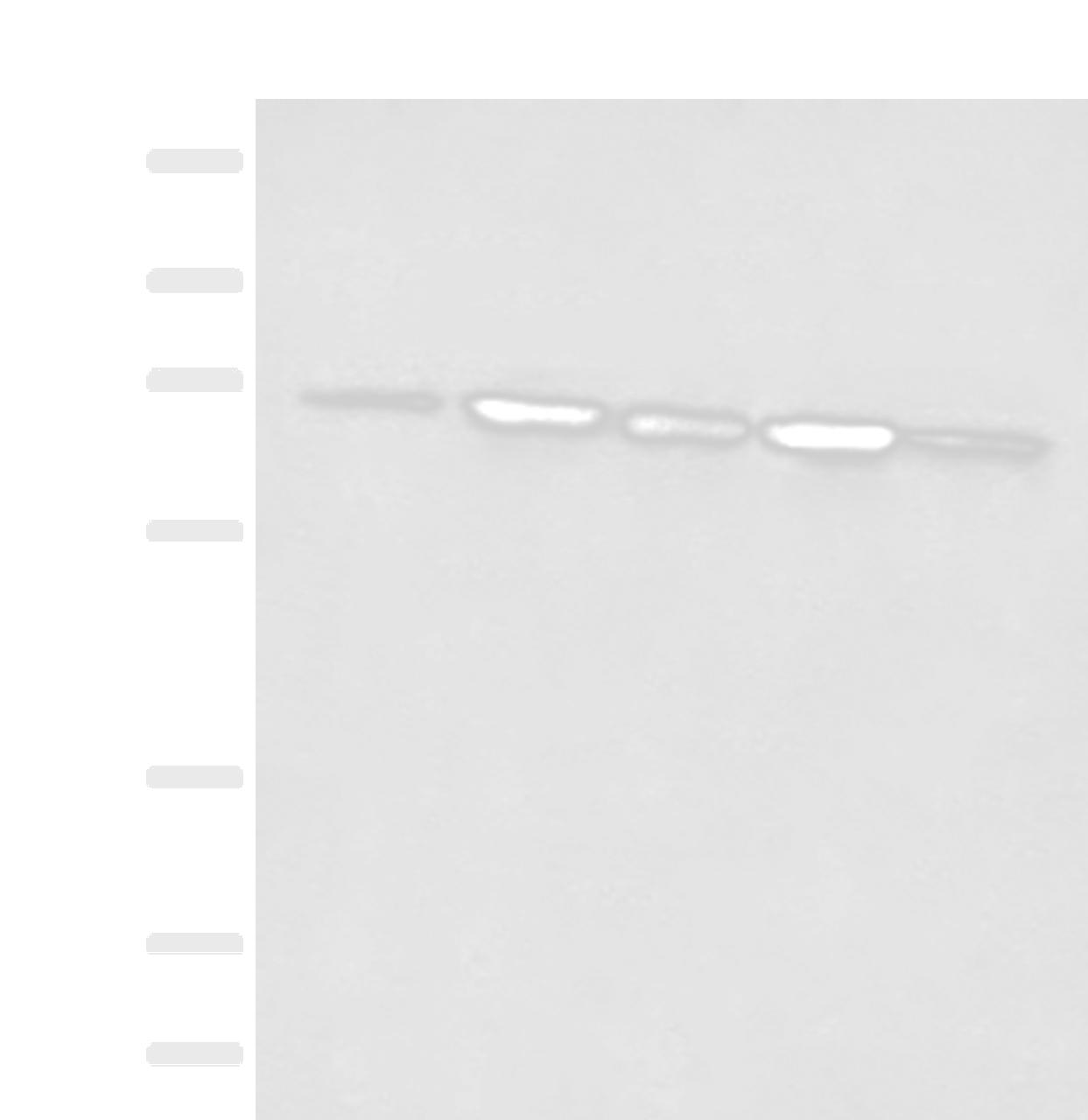 Western blot analysis of 293T cell Rat liver tissue A172 and Jurkat cell lysates  using ACSF2 Polyclonal Antibody at dilution of 1:400