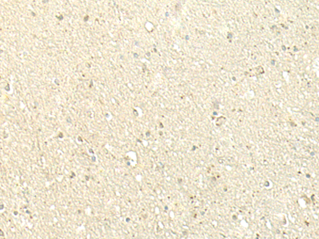 Immunohistochemistry of paraffin-embedded Human brain tissue  using SPIRE1 Polyclonal Antibody at dilution of 1:60(×200)