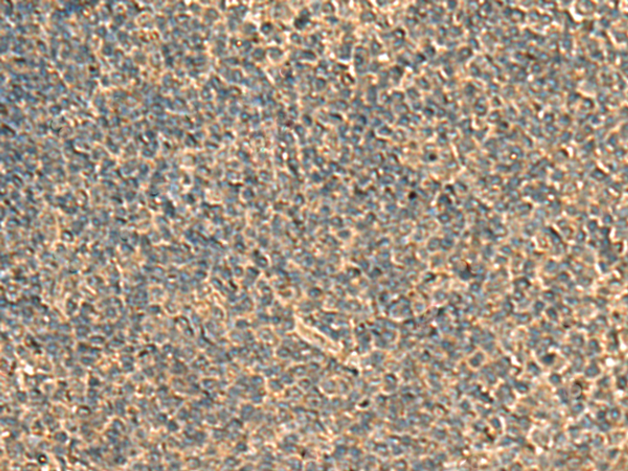 Immunohistochemistry of paraffin-embedded Human tonsil tissue  using RPS11 Polyclonal Antibody at dilution of 1:40(×200)