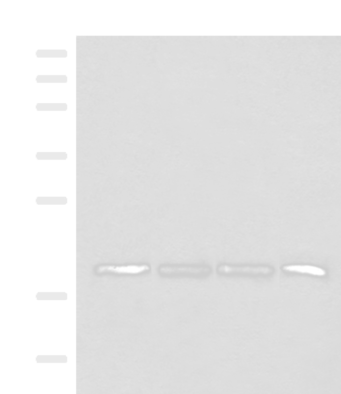 Western blot analysis of TM4 HEPG2 and A549 cell Mouse liver tissue lysates  using SEC11A Polyclonal Antibody at dilution of 1:300