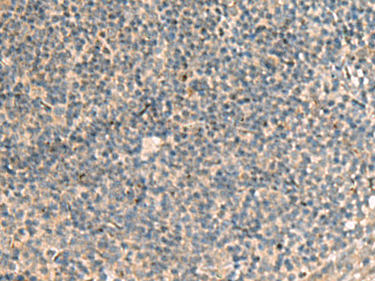 Immunohistochemistry of paraffin-embedded Human tonsil tissue  using POFUT1 Polyclonal Antibody at dilution of 1:50(×200)