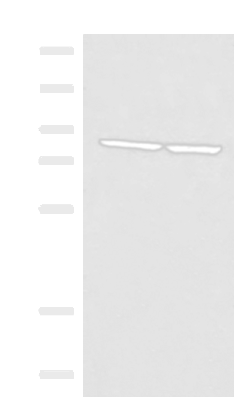Western blot analysis of PC3 and NIH/3T3 cell lysates  using ABLIM3 Polyclonal Antibody at dilution of 1:400