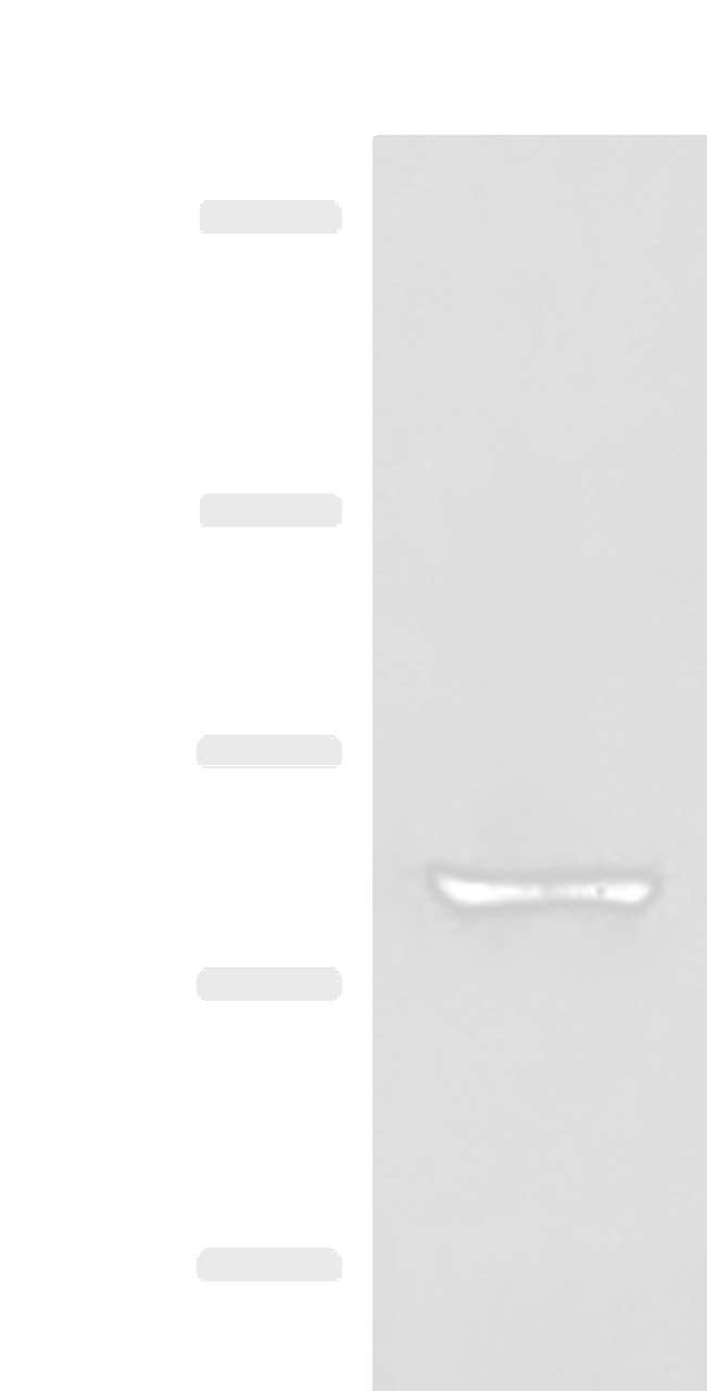 Western blot analysis of Human bladder transitional cell carcinoma grade 2-3 tissue lysate  using TTC12 Polyclonal Antibody at dilution of 1:300