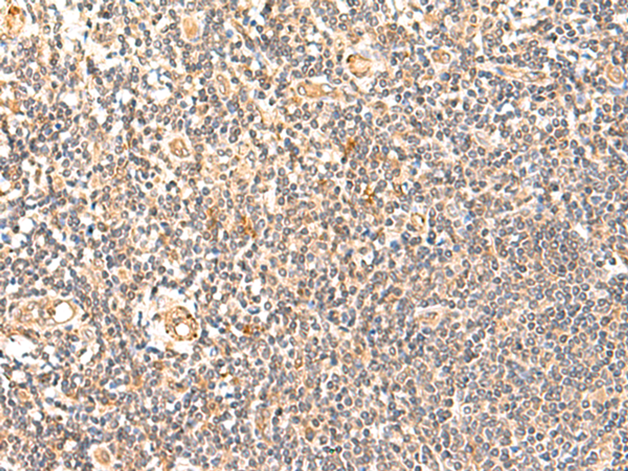 Immunohistochemistry of paraffin-embedded Human tonsil tissue  using GPD1L Polyclonal Antibody at dilution of 1:60(×200)