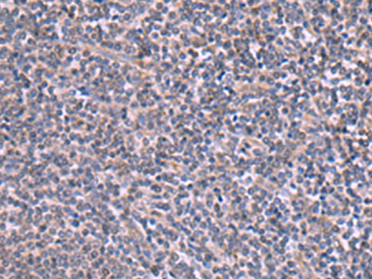 Immunohistochemistry of paraffin-embedded Human tonsil tissue  using RIC3 Polyclonal Antibody at dilution of 1:90(×200)