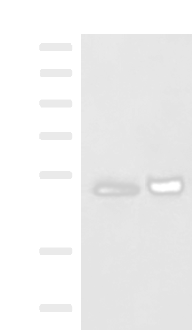 Western blot analysis of Human right lower lung tissue and Human plasma solution lysates  using SIGLEC6 Polyclonal Antibody at dilution of 1:650