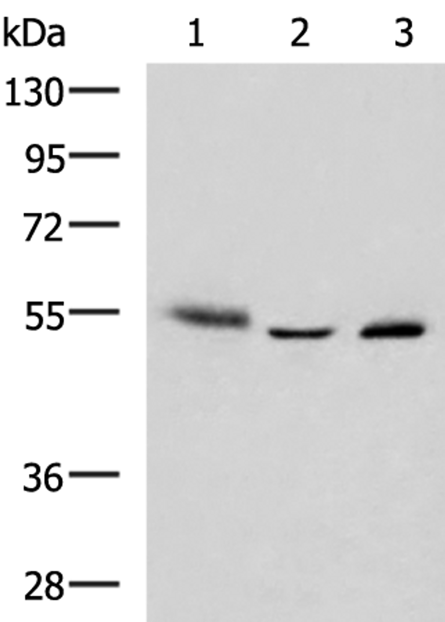 Western blot analysis of Human skin tissue A172 cell Human bladder transitional cell carcinoma grade 2-3 tissue lysates  using IKZF2 Polyclonal Antibody at dilution of 1:950