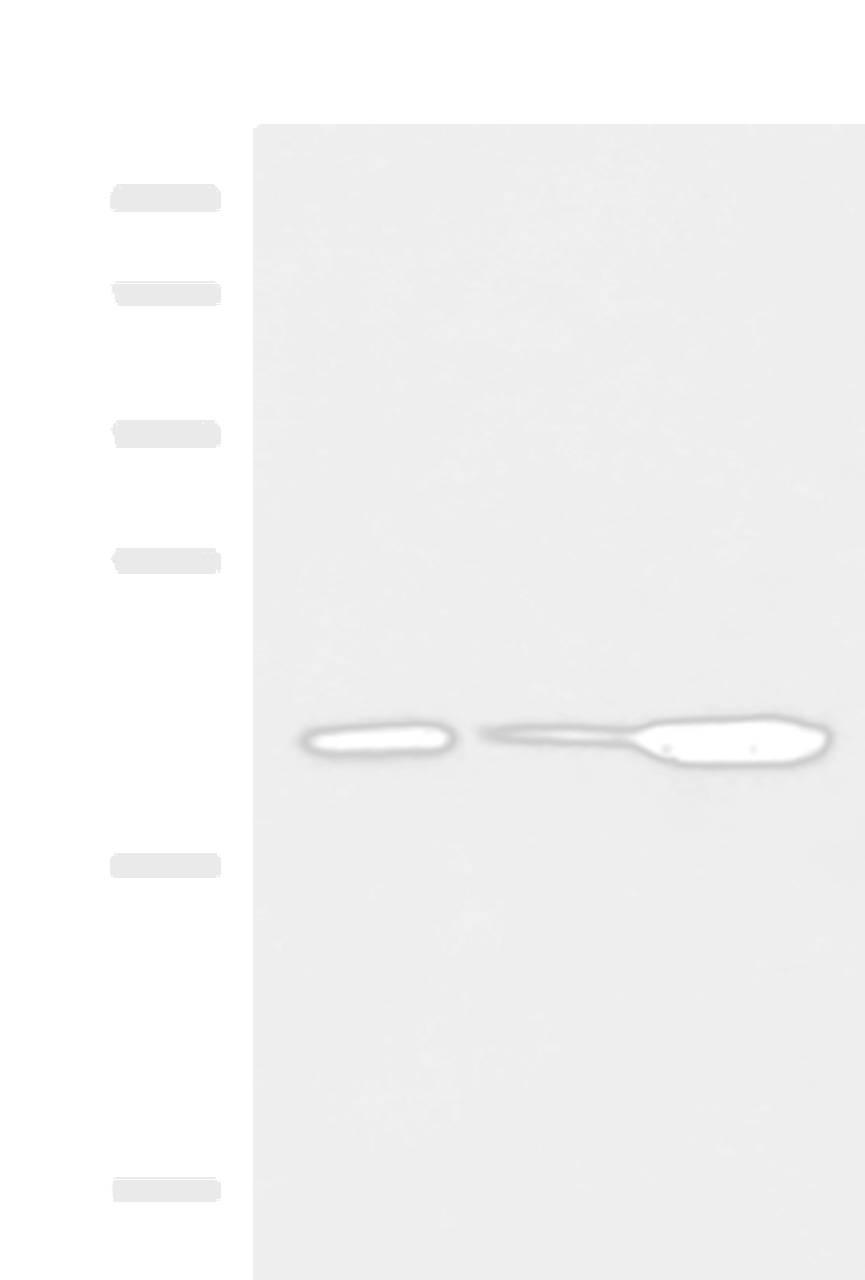 Western blot analysis of Mouse small intestines tissue Mouse kidney tissue Mouse pancreas tissue lysates  using PPIC Polyclonal Antibody at dilution of 1:550