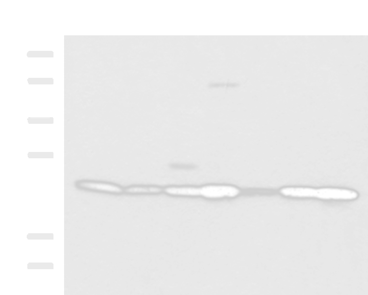 Western blot analysis of SKOV3 Hela cell Mouse liver tissue Mouse heart tissue Human placenta tissue HepG2 cell Human heart tissue lysates  using ATP5O Polyclonal Antibody at dilution of 1:1250