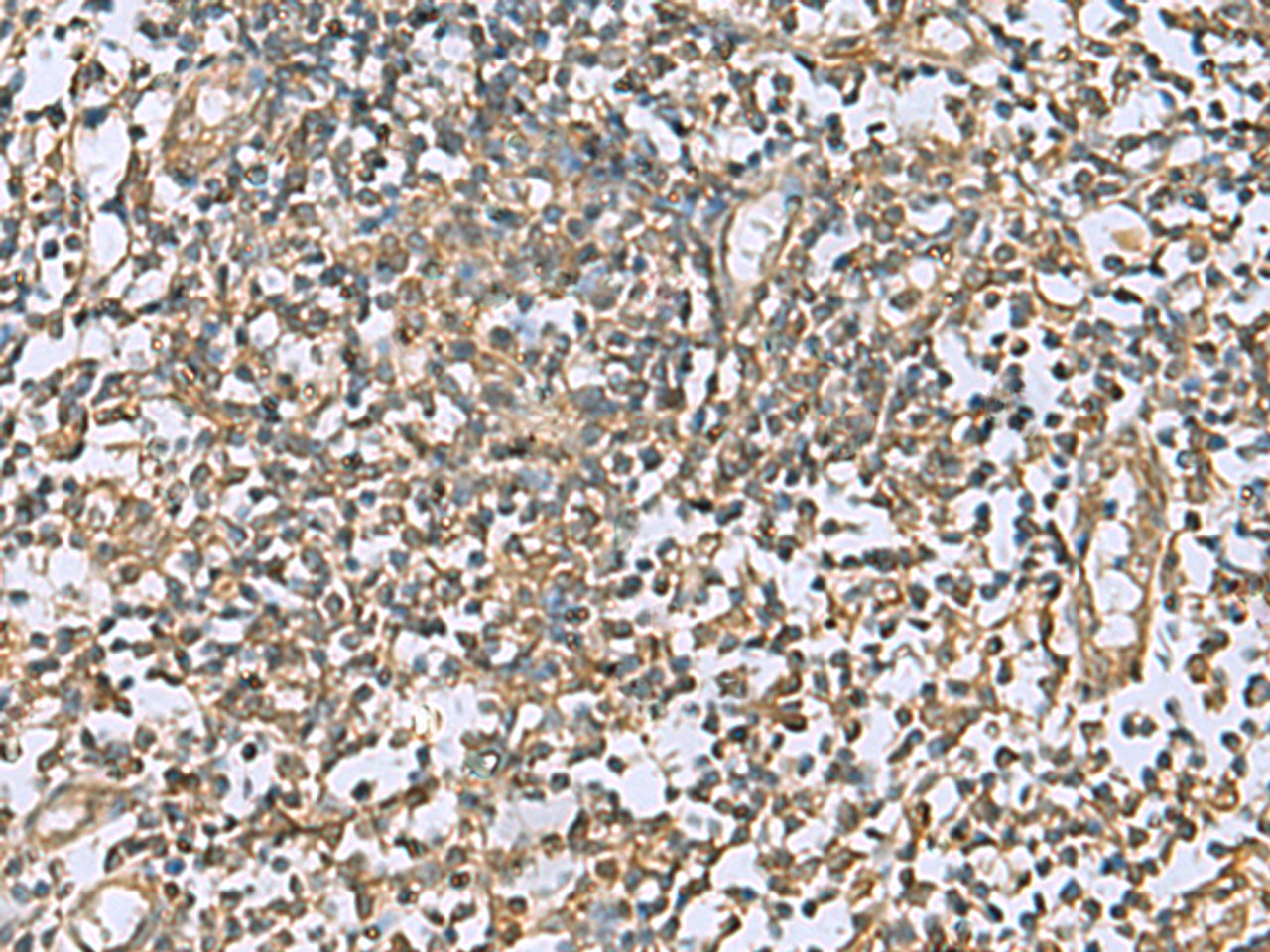 Immunohistochemistry of paraffin-embedded Human tonsil tissue  using LFNG Polyclonal Antibody at dilution of 1:60(×200)
