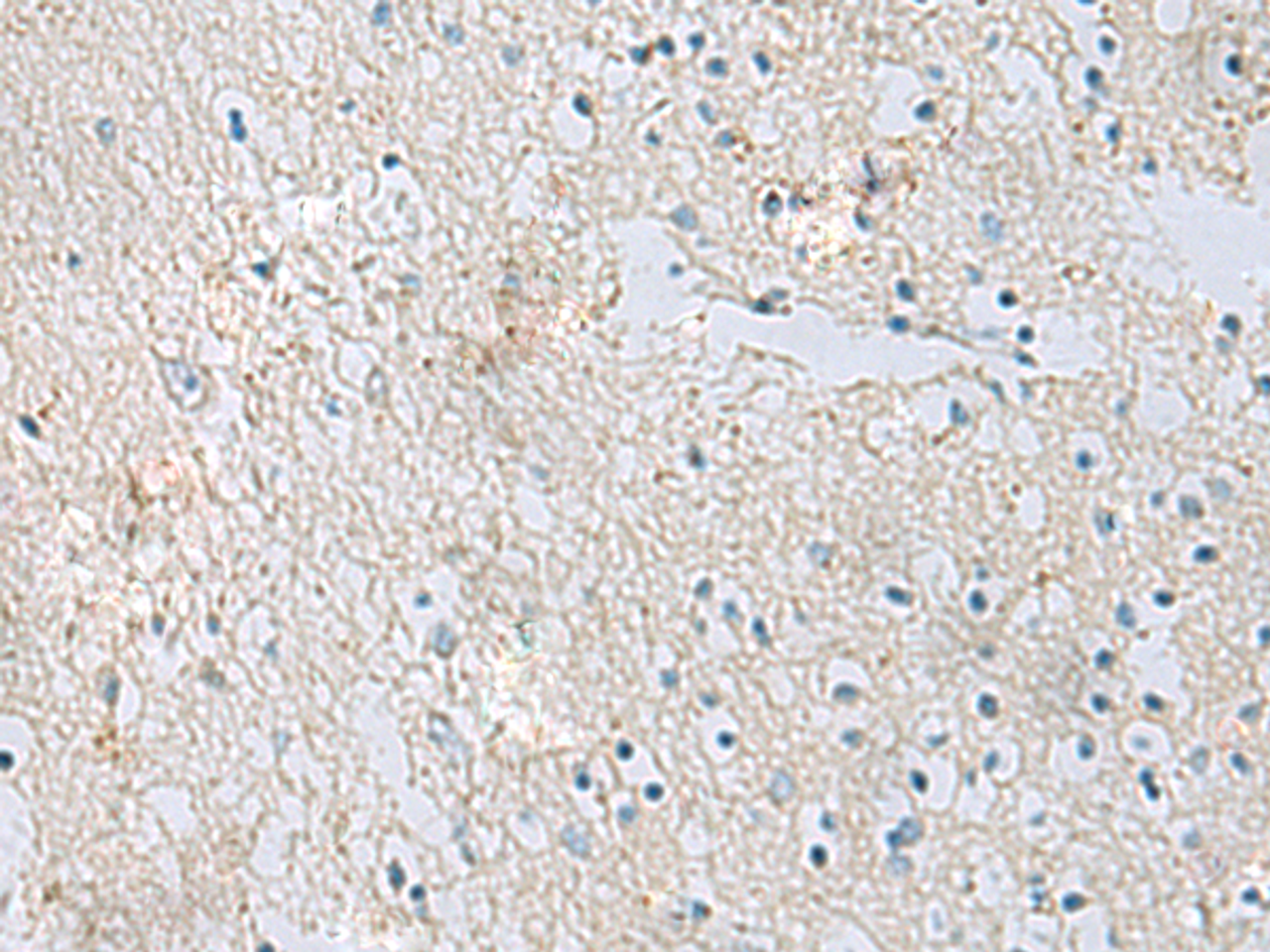 Immunohistochemistry of paraffin-embedded Human brain tissue  using RDH5 Polyclonal Antibody at dilution of 1:50(×200)