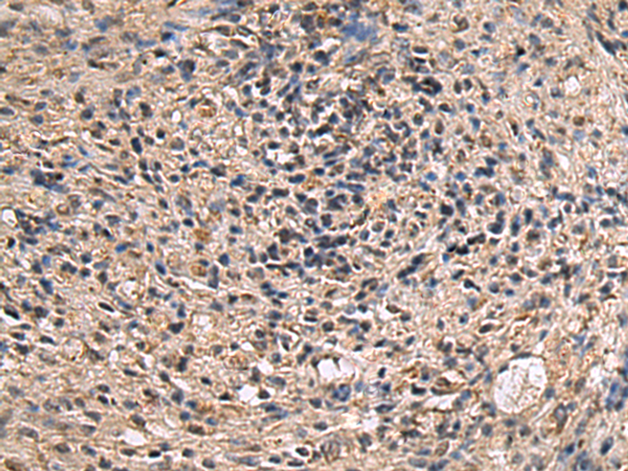 Immunohistochemistry of paraffin-embedded Human brain tissue  using ITIH2 Polyclonal Antibody at dilution of 1:70(×200)