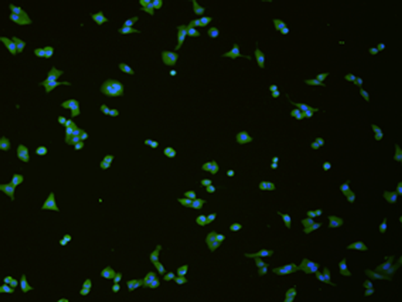Immunofluorescence analysis of hela cell  using SLC18A3 Polyclonal Antibody at dilution of 1:50