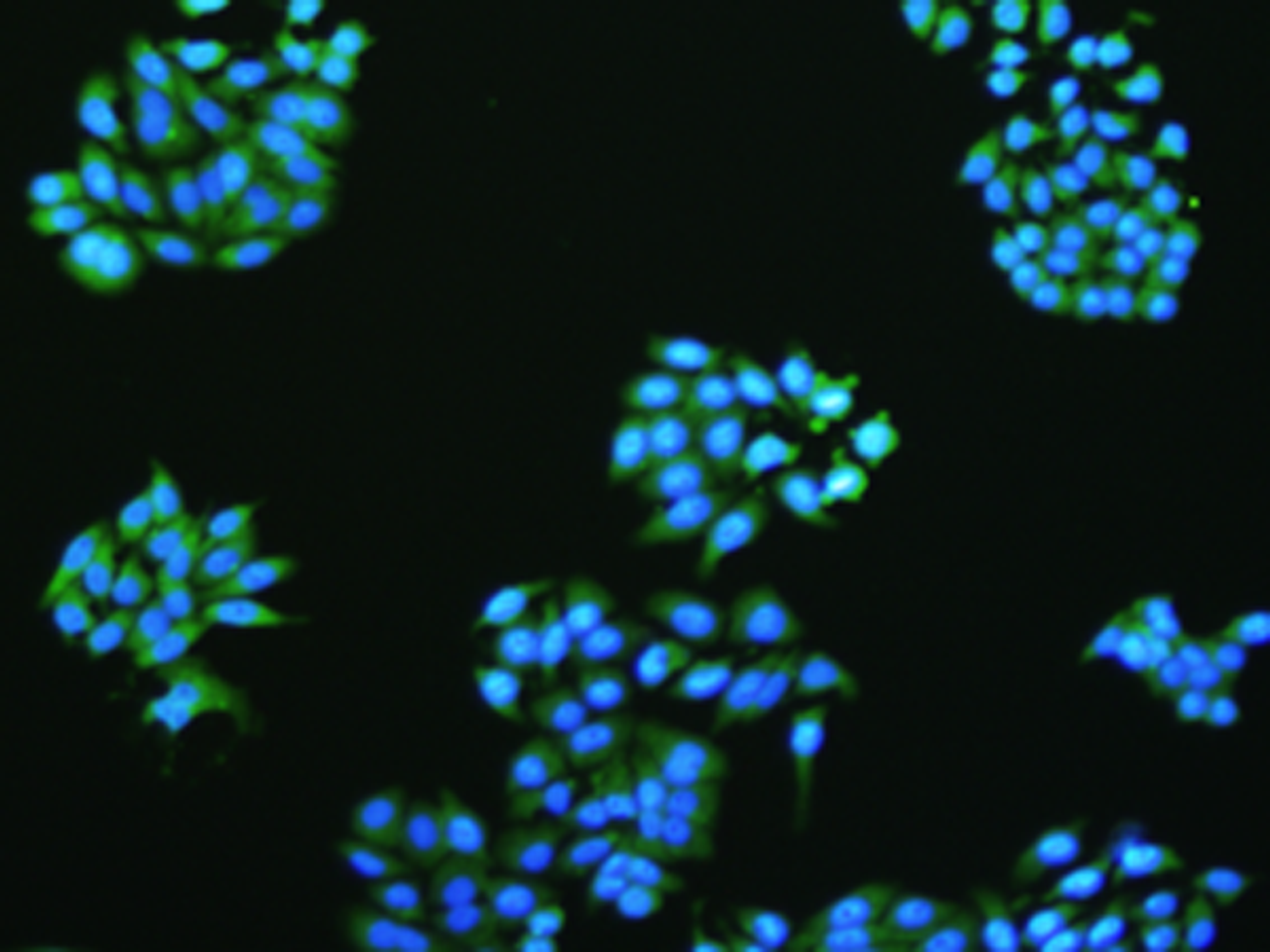The image is immunofluorescence of HepG2 cell  using VMA21 Polyclonal Antibody at dilution of 1:50.