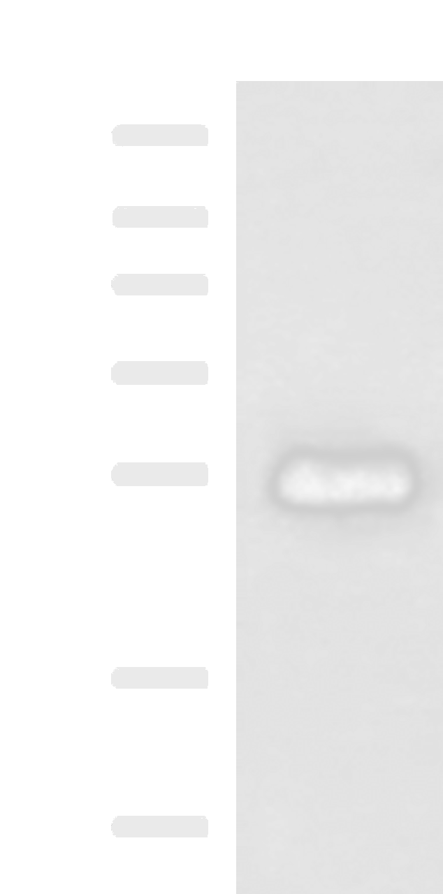 Western blot analysis of Human placenta tissue lysate  using GFRA2 Polyclonal Antibody at dilution of 1:400