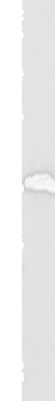 Western blot analysis of Human brain malignant glioma tissue  using P2RY6 Polyclonal Antibody at dilution of 1:550