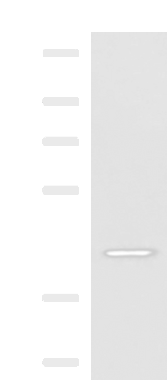 Western blot analysis of Hela cell lysate  using SYT2 Polyclonal Antibody at dilution of 1:800