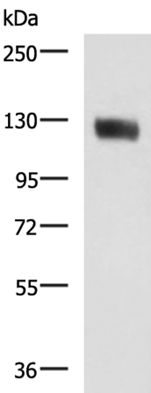 Western blot analysis of Human leiomyosarcoma tissue lysate  using MCAM Polyclonal Antibody at dilution of 1:400