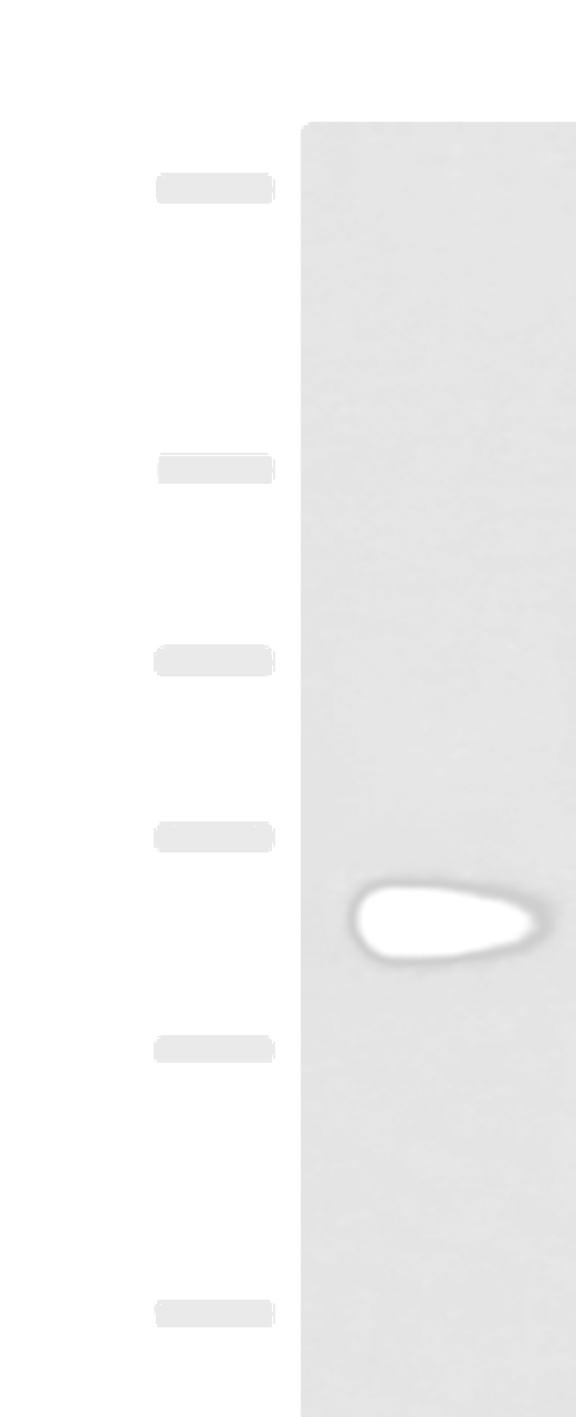 Western blot analysis of Human left kidney paracancerous tissue lysate  using NOTCH4 Polyclonal Antibody at dilution of 1:800