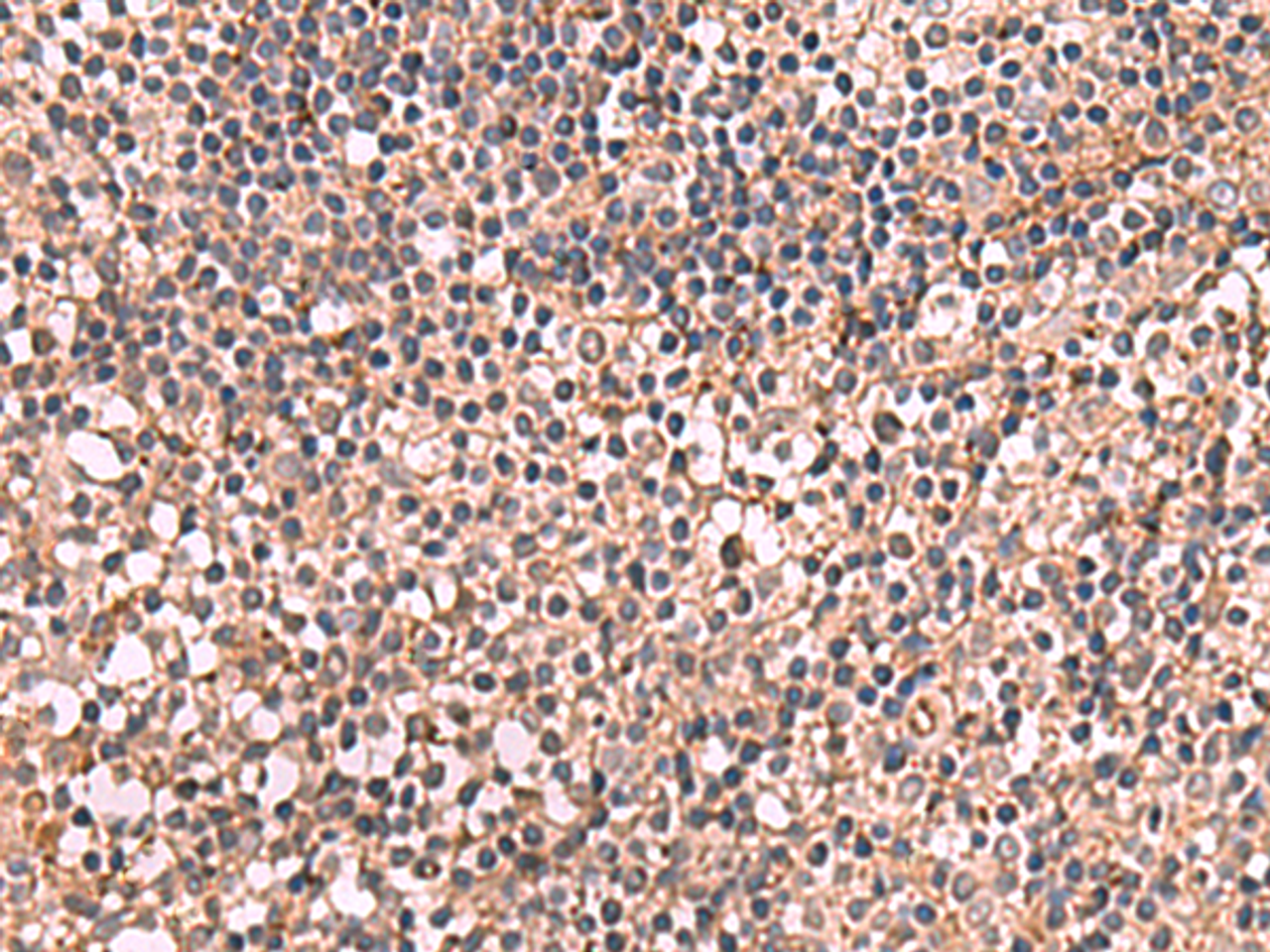 Immunohistochemistry of paraffin-embedded Human tonsil tissue  using NOTCH4 Polyclonal Antibody at dilution of 1:30(×200)
