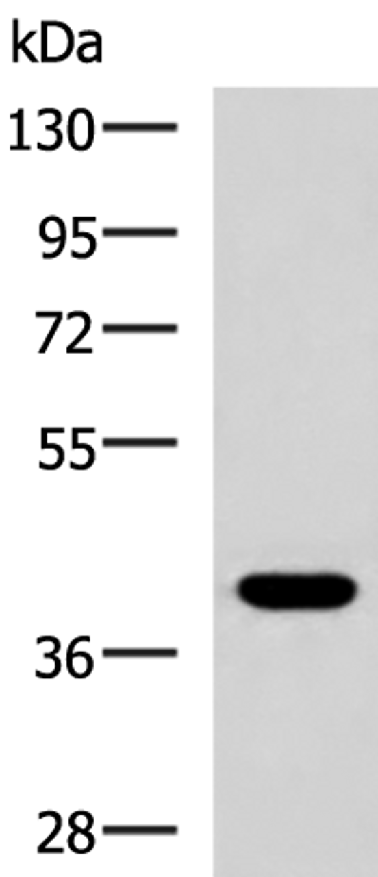 Western blot analysis of HepG2 cell lysate  using PLPPR5 Polyclonal Antibody at dilution of 1:1500