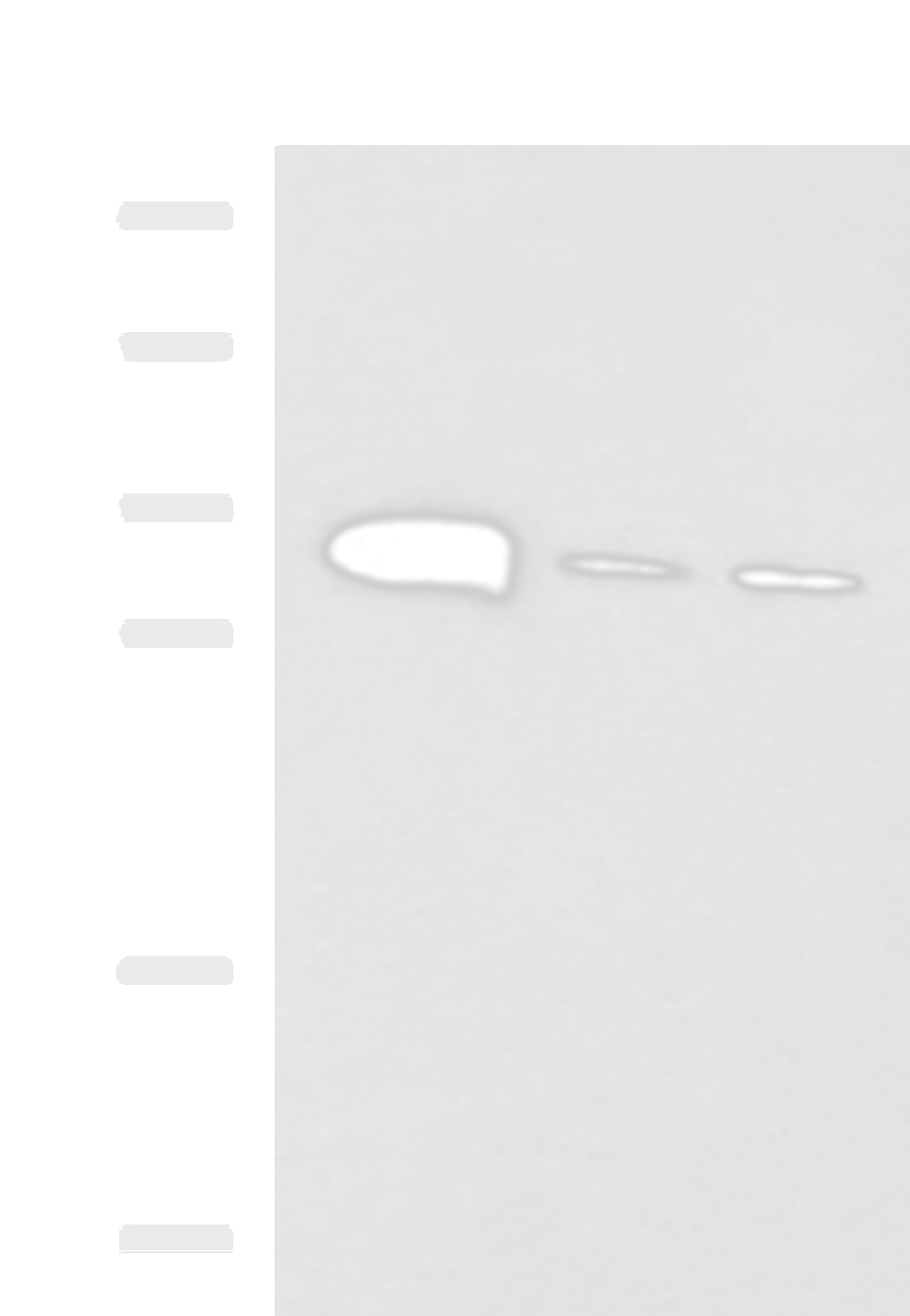 Western blot analysis of Mouse heart tissue Mouse stomach tissue and PC-3 cell lysates  using PSCA Polyclonal Antibody at dilution of 1:650