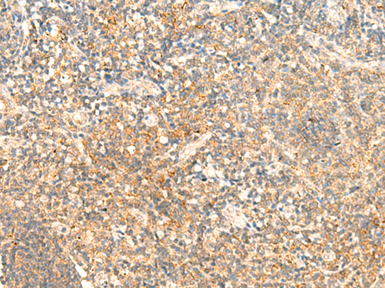 Immunohistochemistry of paraffin-embedded Human tonsil tissue  using CD93 Polyclonal Antibody at dilution of 1:50(×200)
