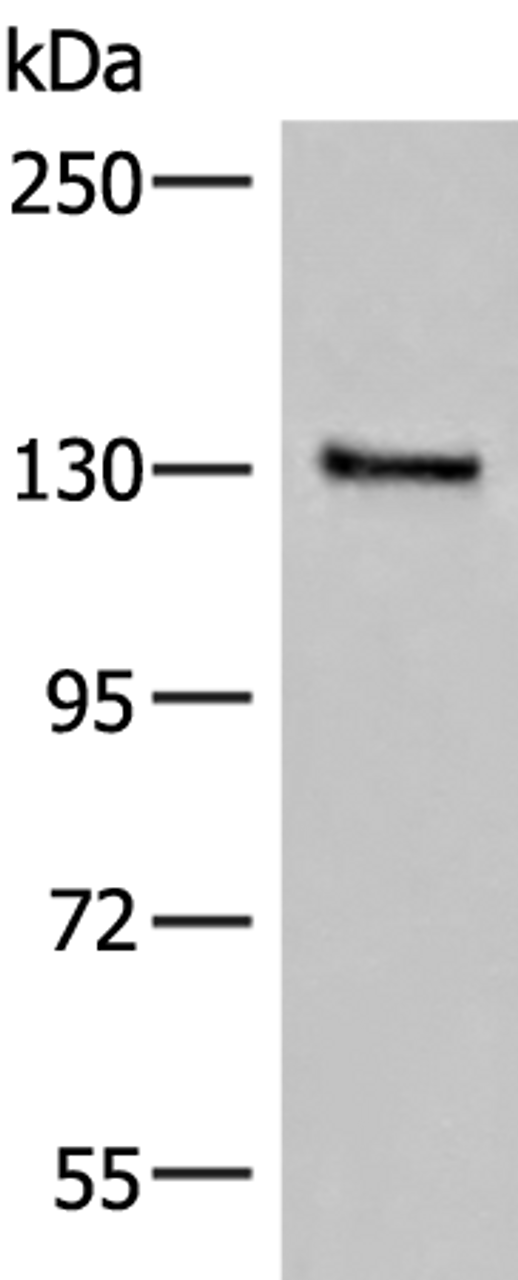 Western blot analysis of Human urinary bladder tissue lysate  using SASH1 Polyclonal Antibody at dilution of 1:300