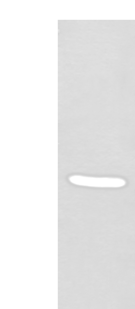 Western blot analysis of Human fetal liver tissue lysate  using TNMD Polyclonal Antibody at dilution of 1:400